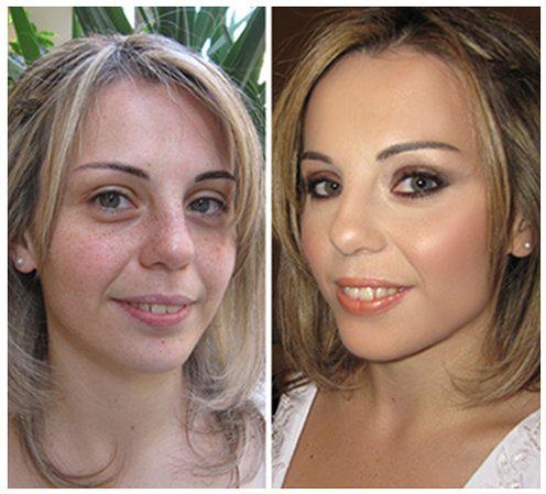 before-after7920132