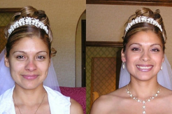 before-after792013