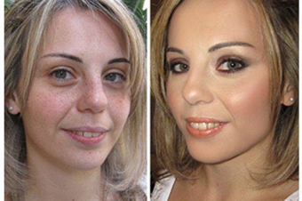 before-after7920132